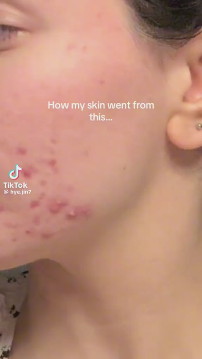 Poremizing deep cleasing foam 125ML- SKIN 1004