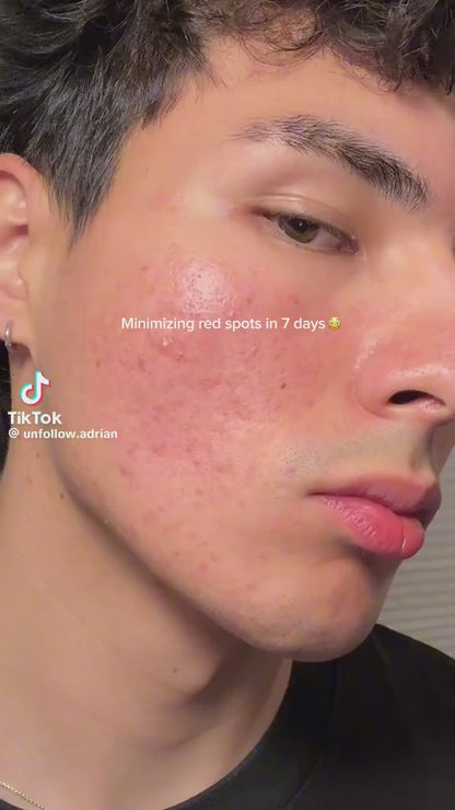 Centella Soothing Cream- Skin 1004