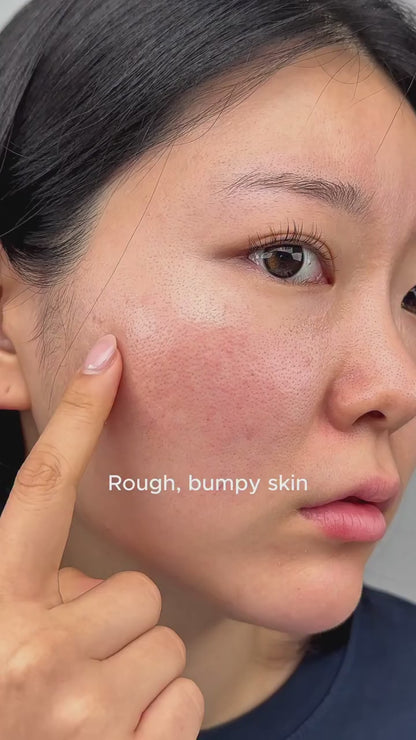 Niacinamide 10% + TXA 4% Serum- ANUA