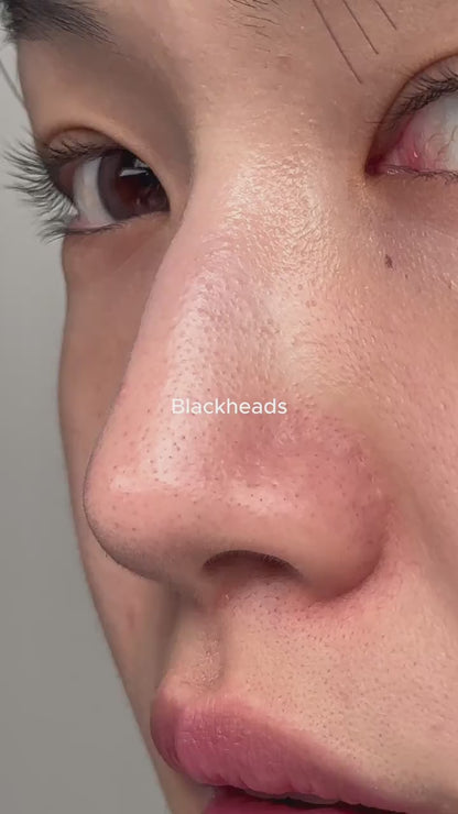 Double Cleansing Set | Doble Limpieza- Mixsoon